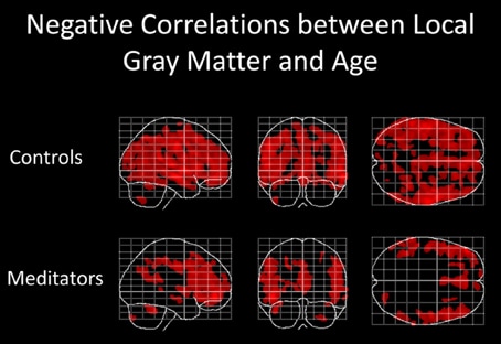 less gray matter decline meditation